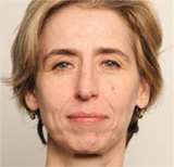 ANNE SUAU